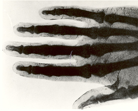 Today in History - November 8, 1895 - Wilhelm Conrad Rontgen discovered x-rays